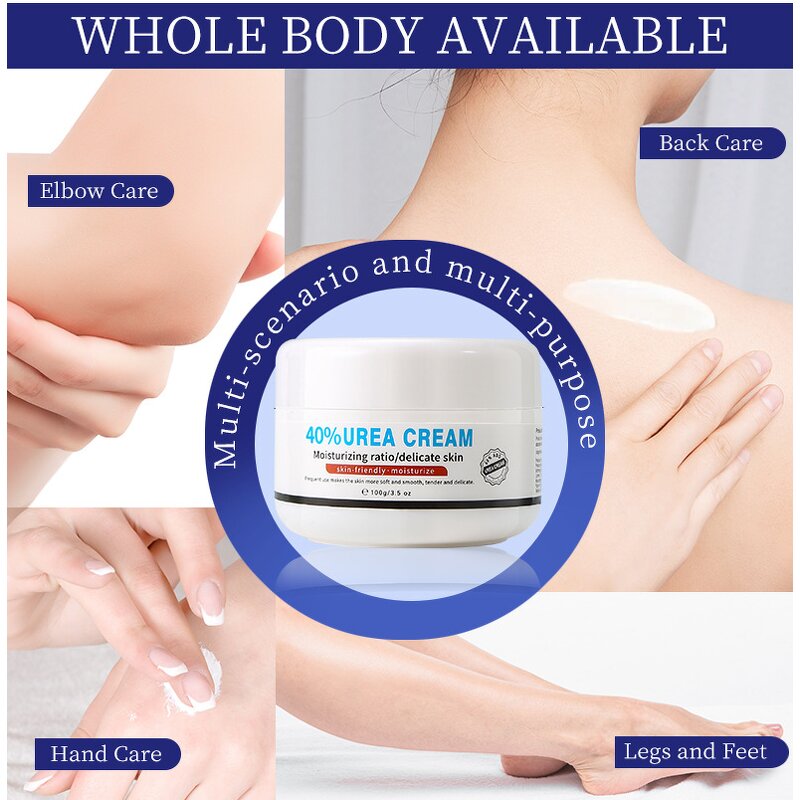 Urea Cream Manufacturer - Stock Moisturizing Skin