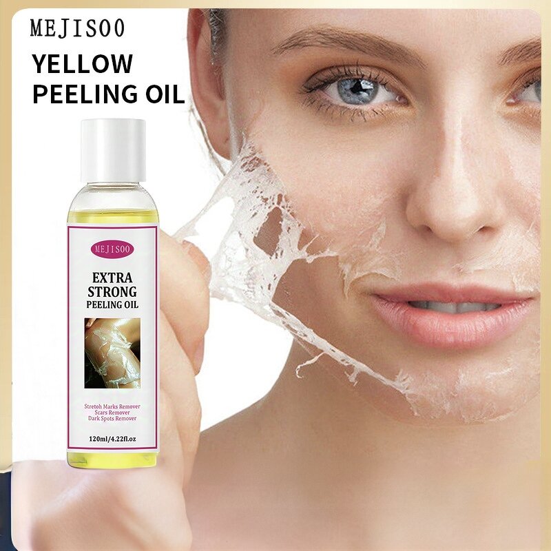 Whitening Peeling Oil Manufacturer - Stretch Marks Remover