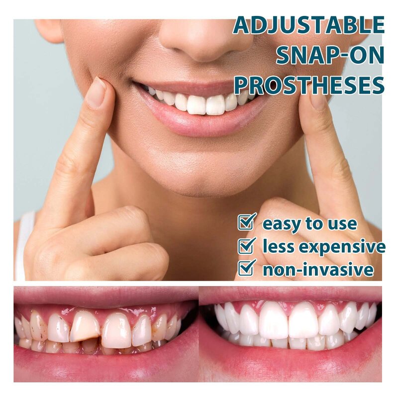 False Teeth Kit Factory - Multi-Purpose Temporary Cover