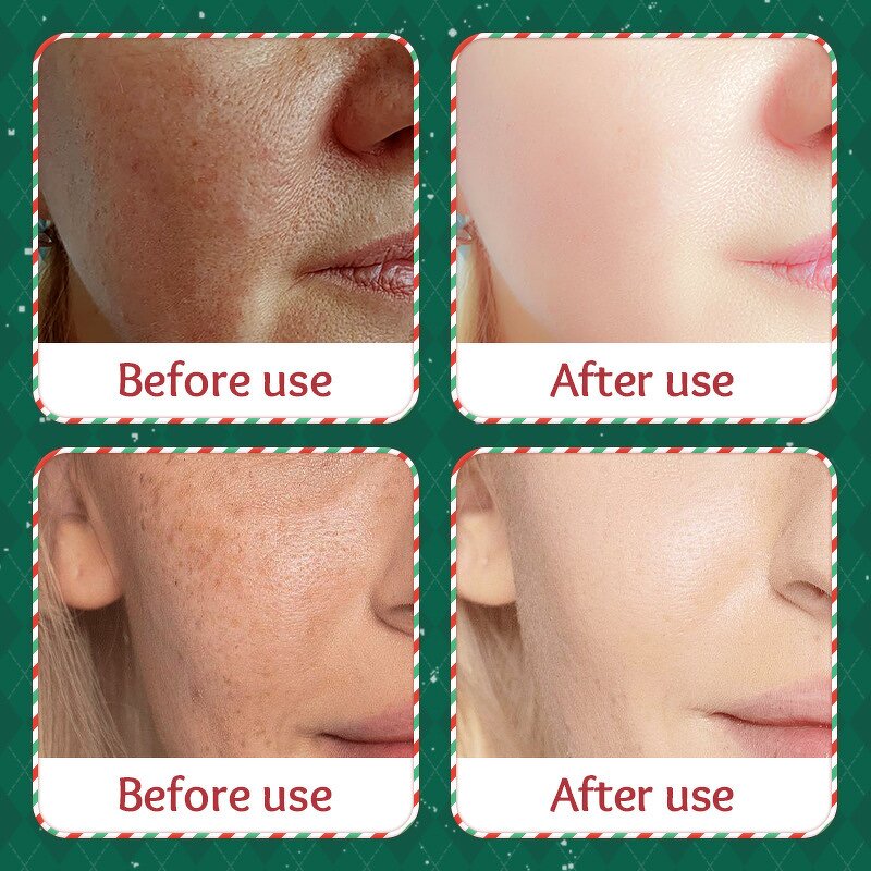 Gold Collagen Mask Manufacturer - Skin Whitening Anti-Wrinkle