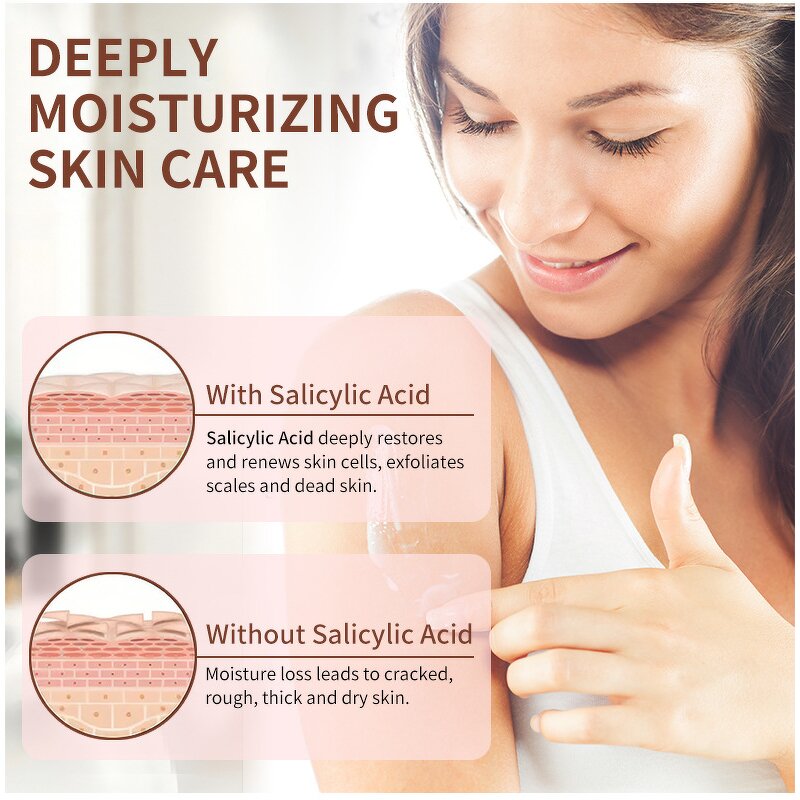 Chicken Skin Cream Factory - Long-Lasting Removes Pimples