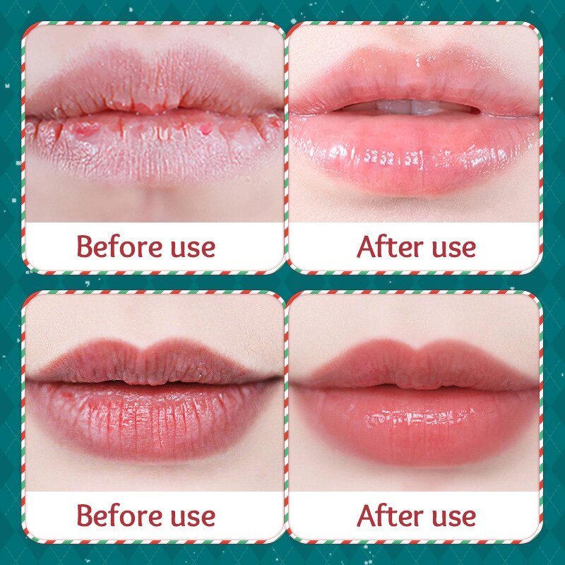 Christmas Lip Balm Manufacturer - SADOER Moisturizing Anti