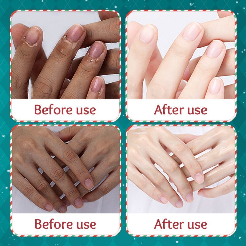 Herbal Hand Cream Manufacturer - Wholesale Autumn Winter