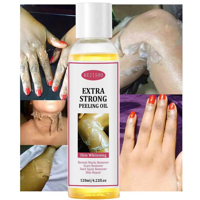 Whitening Peeling Oil Manufacturer - Stretch Marks Remover