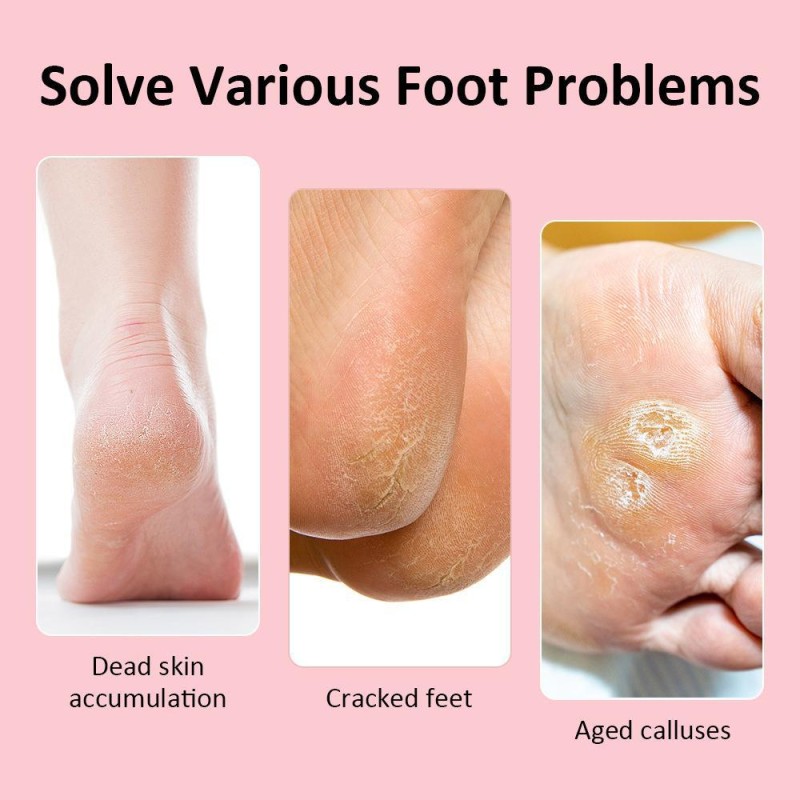 Foot Skin Care Machine Factory - OEM 2025 New Trends USB Type-c Foot Grinder Electric Pedicure