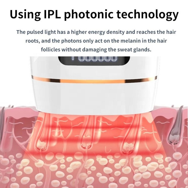 IPL Hair Removal Device Supplier - OEM New Trends Professional ICE Cool Permanent Epilator