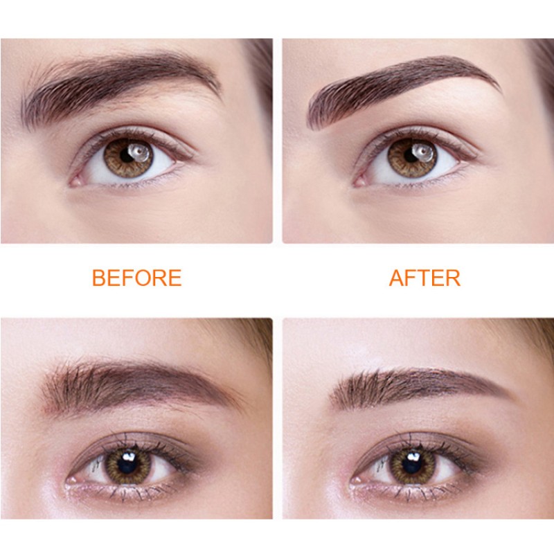 Eyebrow Trimmer Supplier - OEM Electronic Battery Operated Painless Hair Epilator Small Women