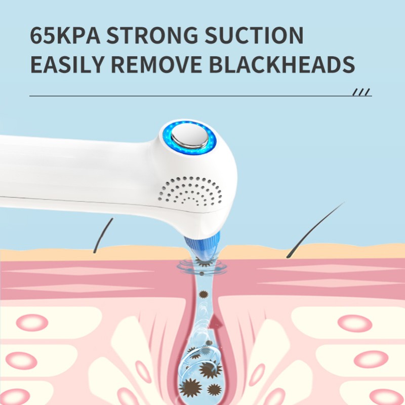 Acne Removal Device Supplier - OEM New Trends Electric Vacuum Suction Hot Cold Pore Cleaner