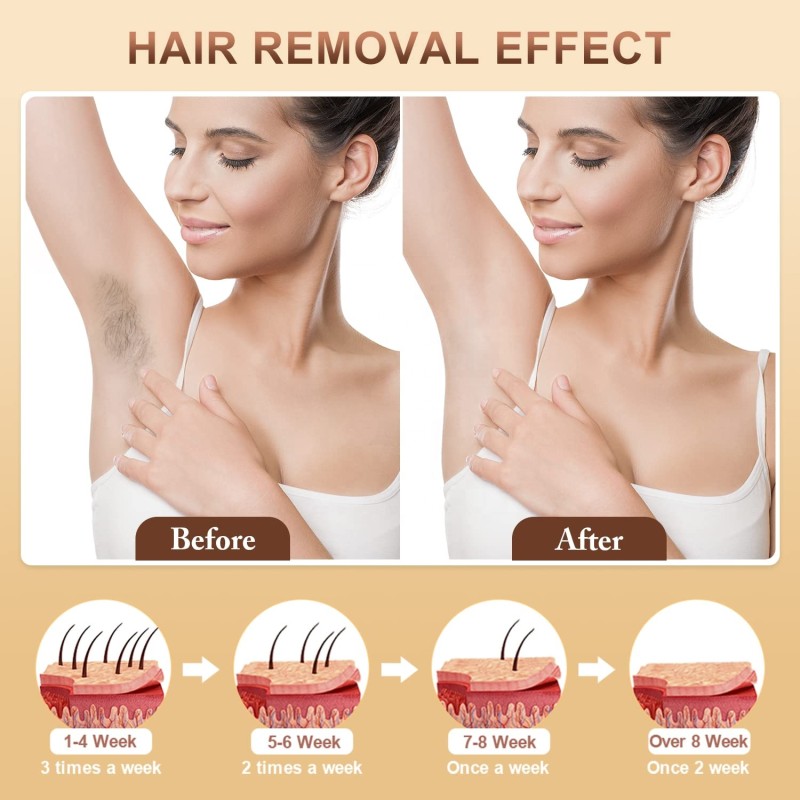 IPL Laser Hair Removal Manufacturer - OEM Professional Painless Permanent Hair Removal Device