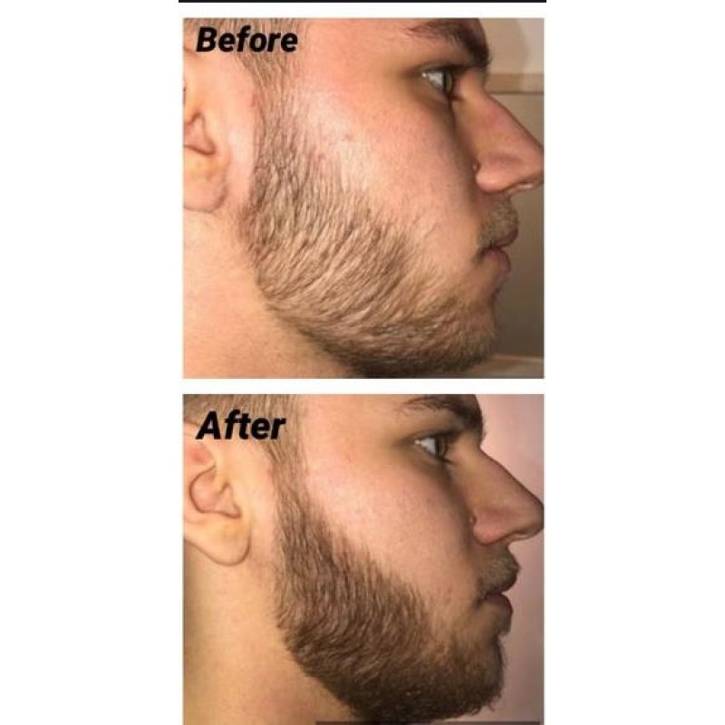 Beard Pen Factory - OEM High Pigment Filling Kit