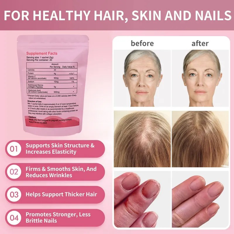 Hydrolyzed Collagen Peptides Manufacturer - OEM 5000MG per Serving Beauty Whitening Elasticity