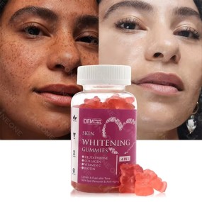 Skin Whitening Gummies Factory - OEM Best Lightening Even Skin Tone Remove Dark Spots Biotin