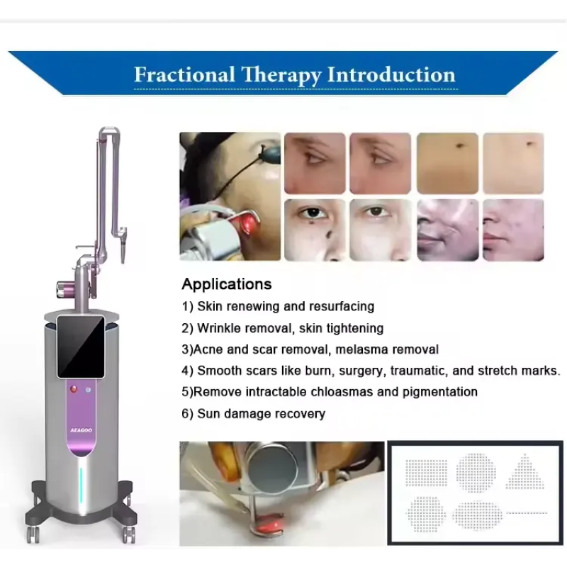 CO2 Laser Machine Supplier - Bulk 2025 Newest 60W CO2 Laser 10600nm Skin Resurfacing Scar