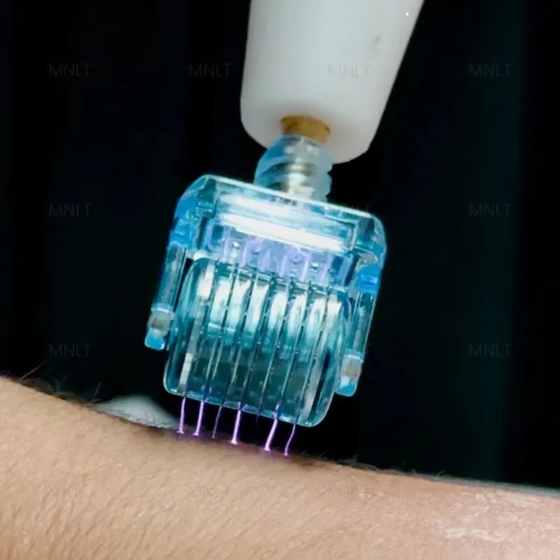 Plasma Pen Supplier - Bulk Hot Sale Generation Wrinkle Removal Plasma Pen Medical LED