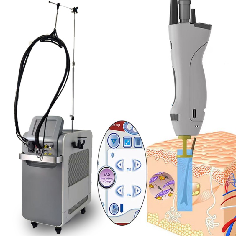 Hair Removal Machine Supplier - Bulk Alexandrite Laser 755nm 1064nm Long Pulse Depilation