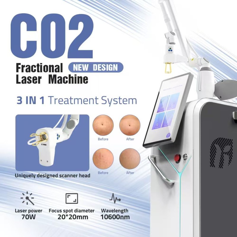 Picosecond Laser Factory - OEM 2025 Hot Sell 1064nm 532nm 755nm Picosecond Skin Rejuvenation