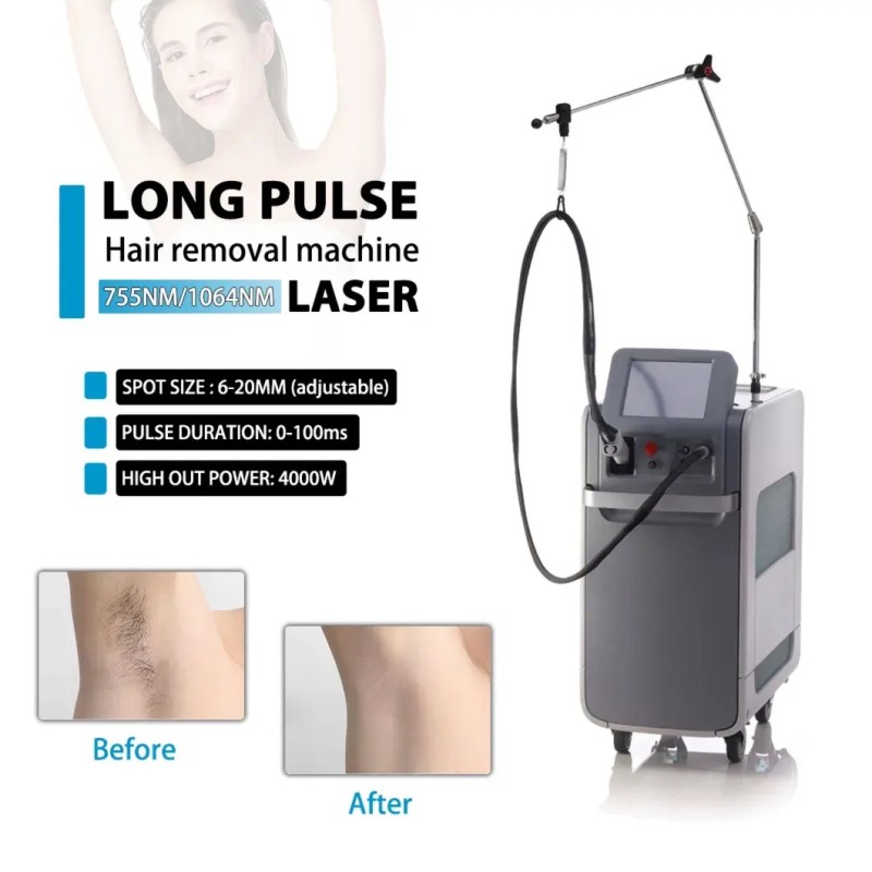 Laser Hair Removal Supplier - Bulk Dual-wavelength 755nm+1064nm Alexandrite Long Pulse