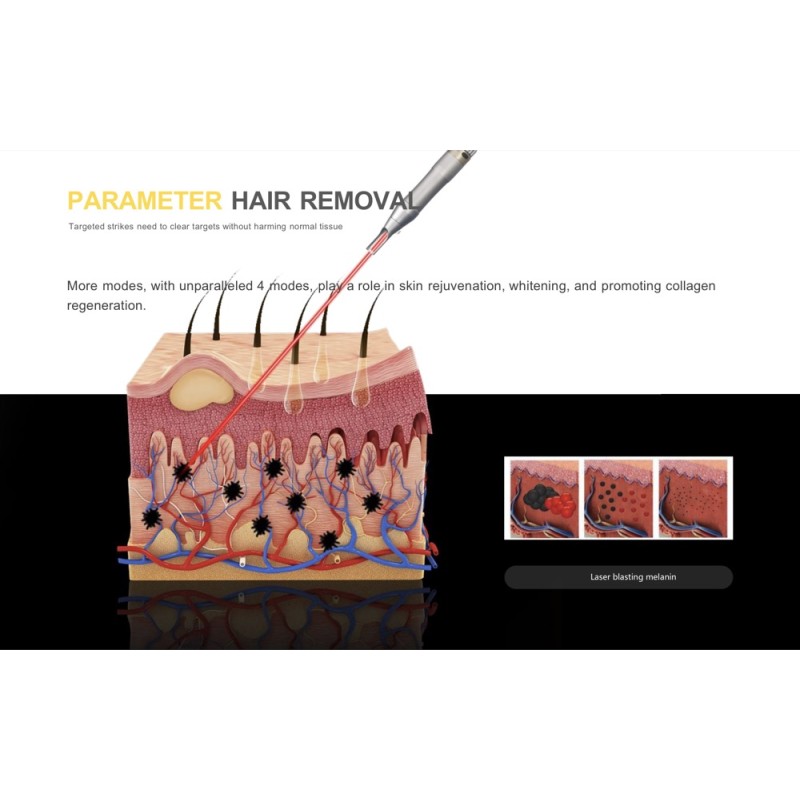 Beauty Machine Supplier - OEM Best Selling Q -switch Laser Tattoo Removal Cooling System