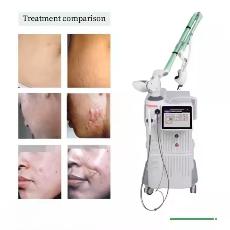 Nd Yag Laser Factory - OEM Hot Selling 1064nm Nd Yag 2940nm Erbium Laser Face Lift