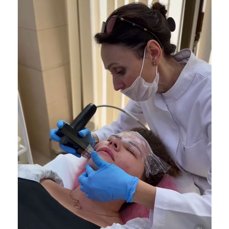 RF Microneedles Manufacturer - OEM 10P 25P 64-P Nano Cartridges Gold Plated Insulated Tips