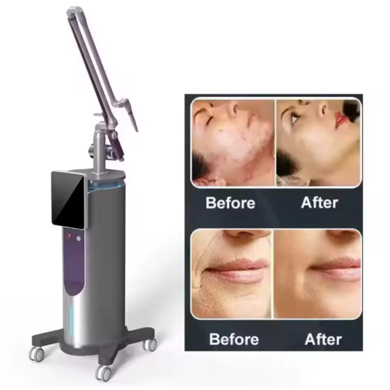 Skin Analyzer Factory - OEM Portable 3D Skin Analyzer 2025 Facial LCD Wifi AI Technology