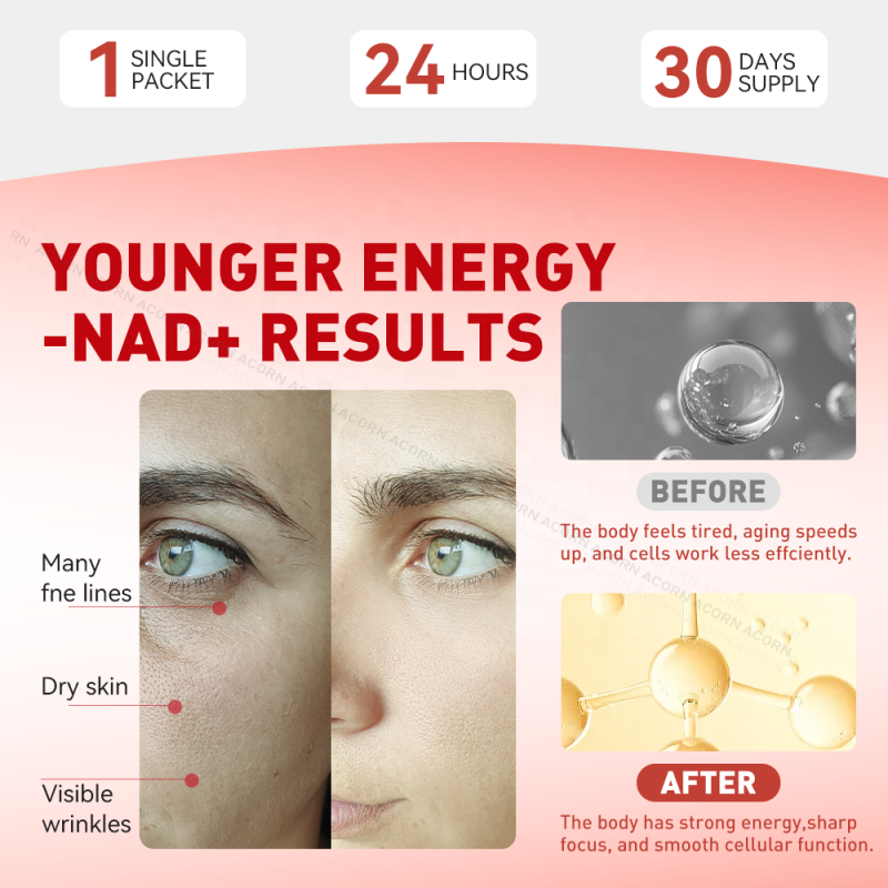 ACORN Private Label NAD Supplements Beverage Energy Support Berry Flavor NAD+ 1000mg Nicotinamide Drink for Adult