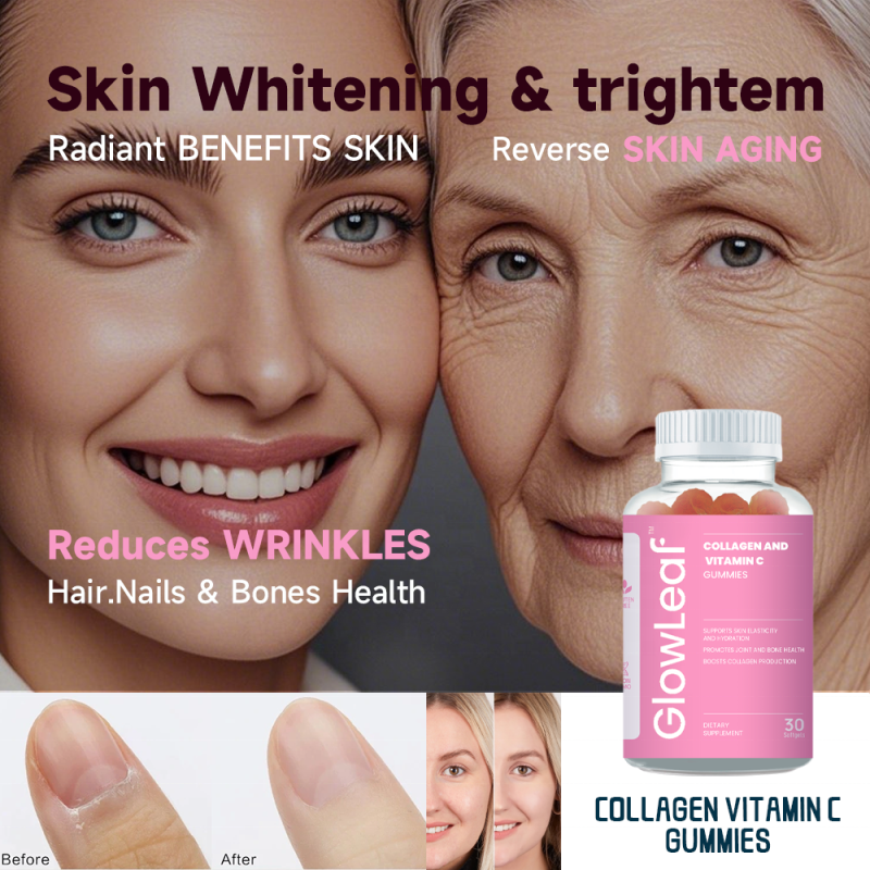 Acorn Dietary Supplement Manufacturer Collagen Gummies Supplement Collagen Gummies for Skin