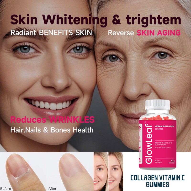 Acorn Collagen Gummies for Skin Whitening Collagen Whitening Gummies