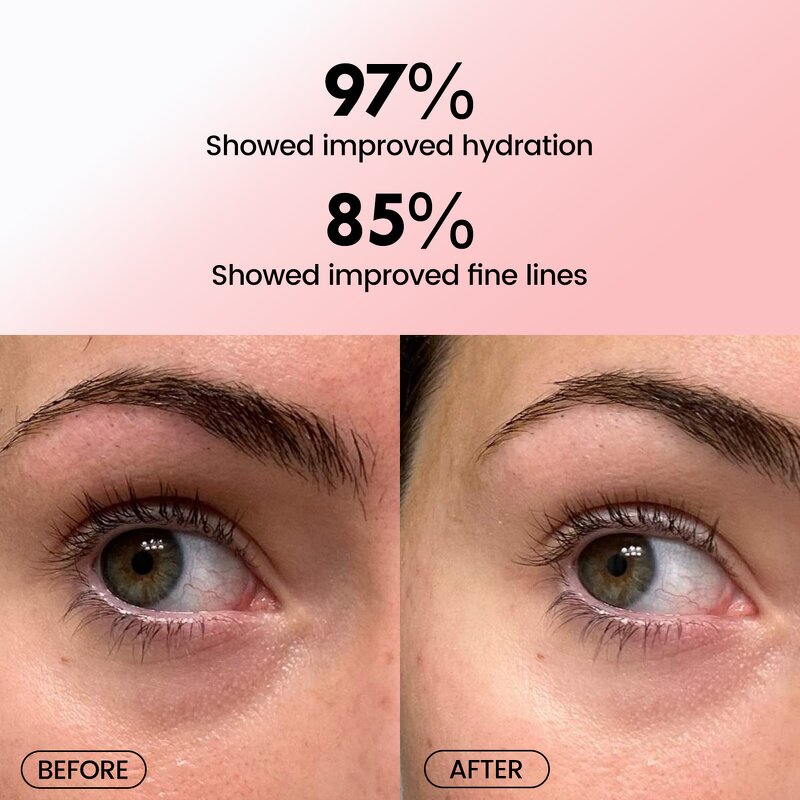 Eye Patch Factory - OEM Private Label Anti-acne Pink Moisturizing