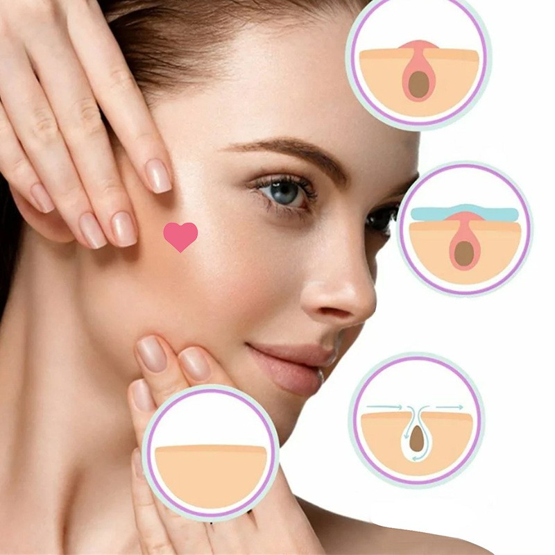 Acne Removal Patch Factory - Bulk Pink Heart Acne Removal Patch Cleansing Closed Comedones