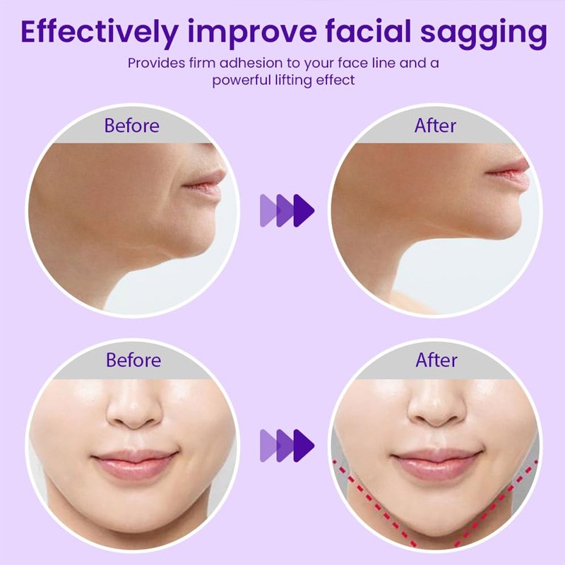 V Face Pad Factory - Bulk V Face Facial Pad Ear Hanging V Face Lifting and Tightening