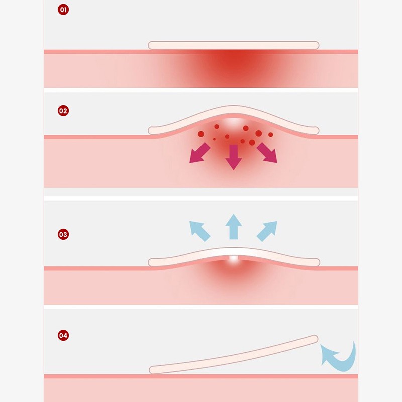 Pimple Patches Supplier - Bulk Colorful Christmas Design Cute Pimple Removal Patches Star