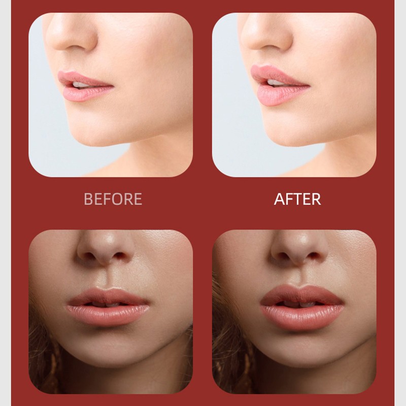 Automatic Lip Plumper Factory - Bulk Factory Direct Sales USB Rechargeable Automatic Lip