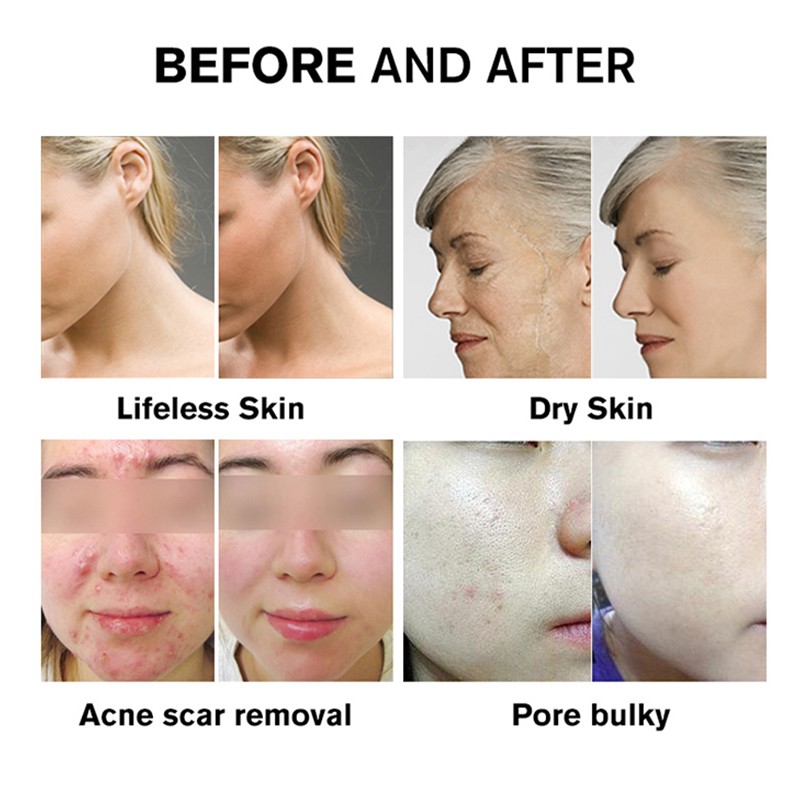 Sleep Aid Device Supplier - OEM New Sleep Aid Therapy Device Relieves Insomnia Portable