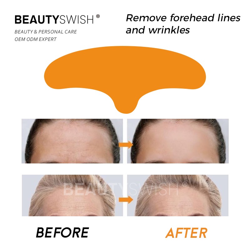Collagen Patch Factory - OEM Collagen Peptide Anti Aging Anti Wrinkles Forehead Lines