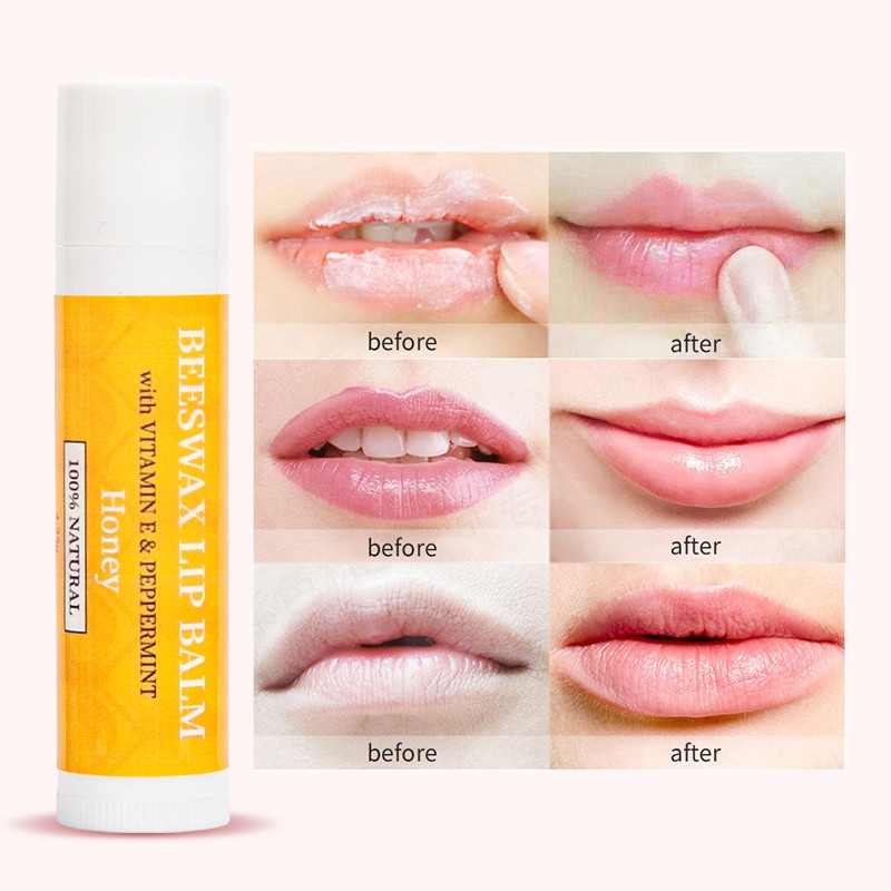 Electric Lip Plumper Supplier - Bulk Natural Sexy Mouth Lip Enlargement Plumping Machine