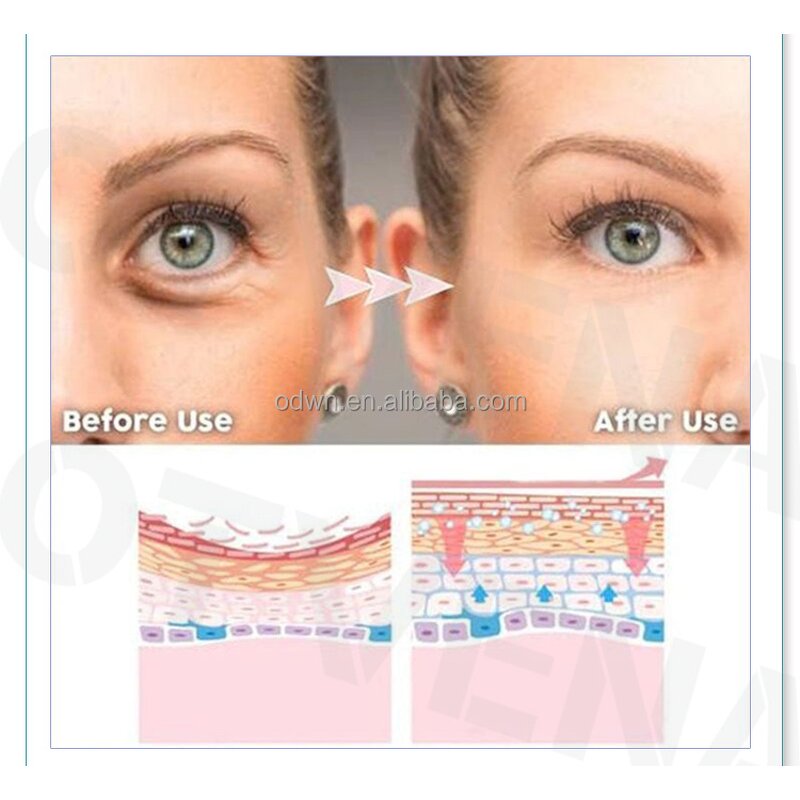 Eye Cream Manufacturer - Custom Anti Wrinkle & Eye Bag Removal