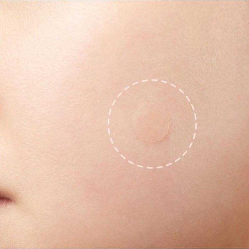 Acne Patch Manufacturer - Wholesale Microneedle Pimple Treatment
