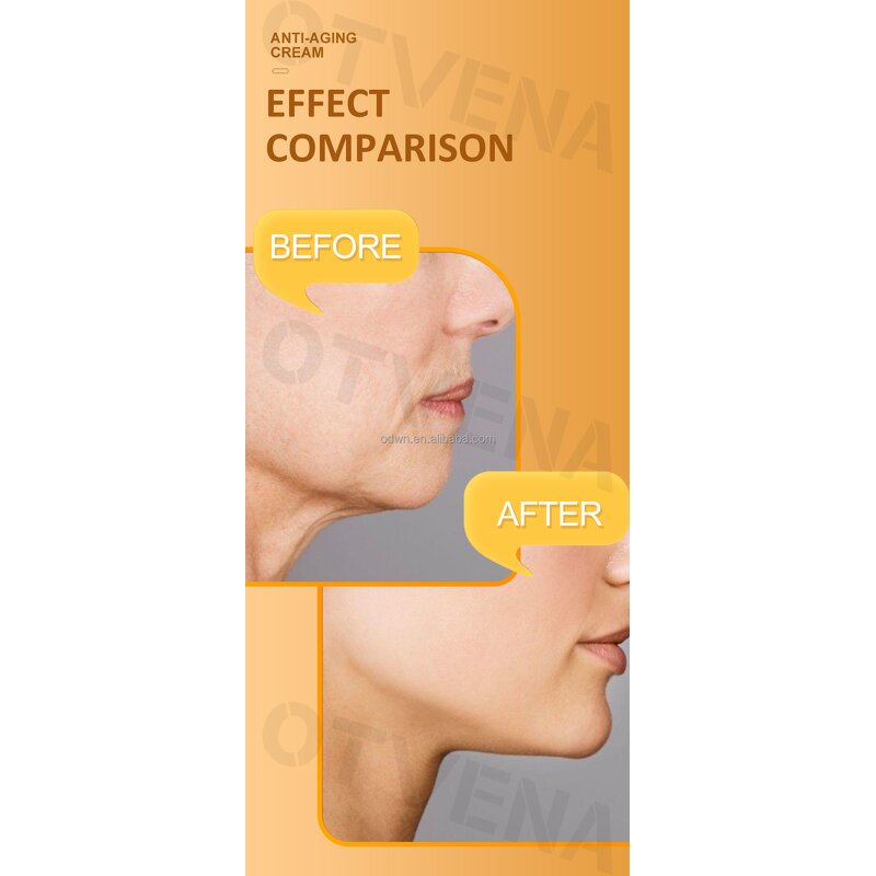 Anti Aging Cream Manufacturer - Anti Wrinkle Gel Peptide Instant Tightening