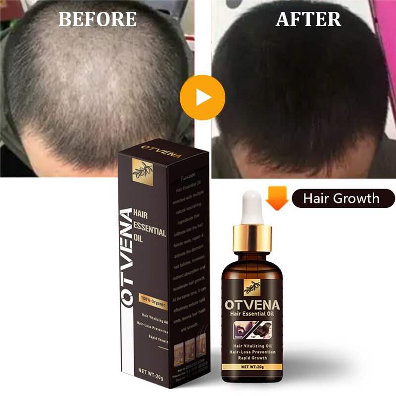 Hair Growth Oil Manufacturer - Private Label Organic Promote Growth