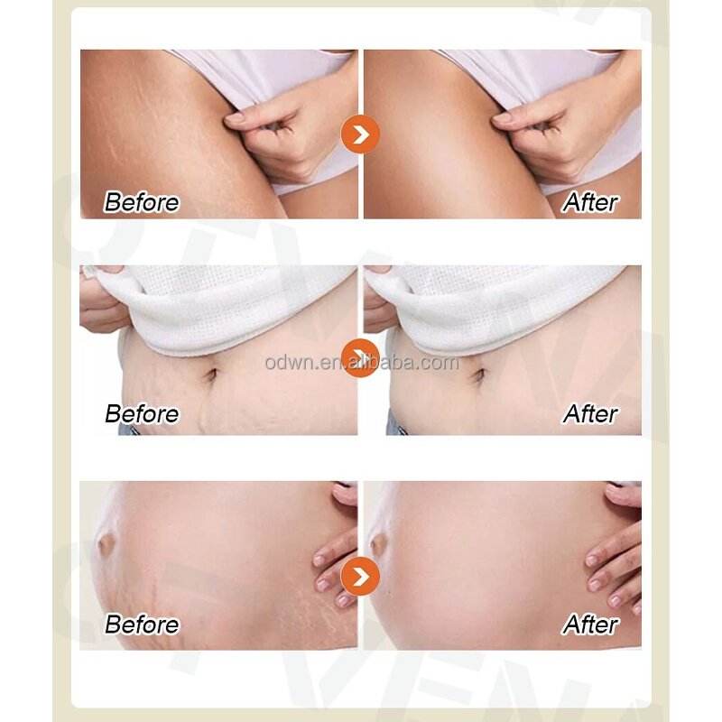 Slimming Cream Manufacturer - 7 Day Fat Burning Natural Herbal Extracts