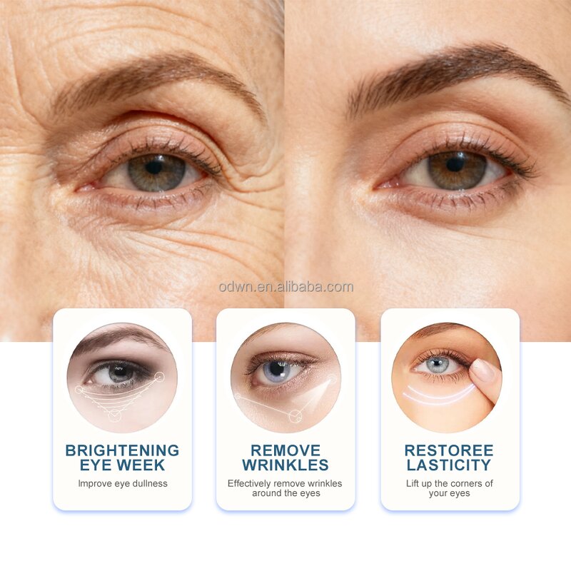 Eye Cream Manufacturer - OEM Dark Circle & Fine Lines Removal 8ml