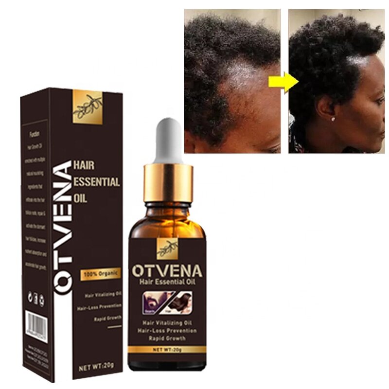 Hair Growth Oil Manufacturer - Private Label Organic Promote Growth