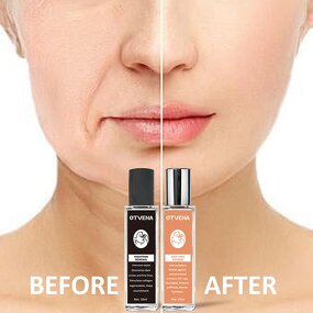 Eye Serum Manufacturer - Famous Brand Day Night Repair Blue Light Defense
