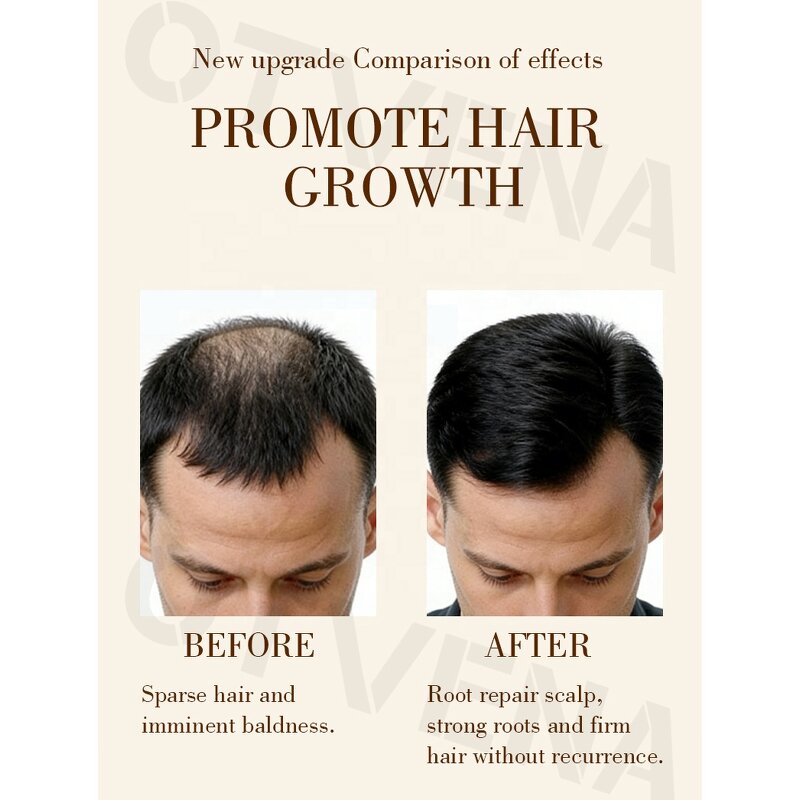 Hair Growth Oil Manufacturer - Natural for Hair & Beard See Results