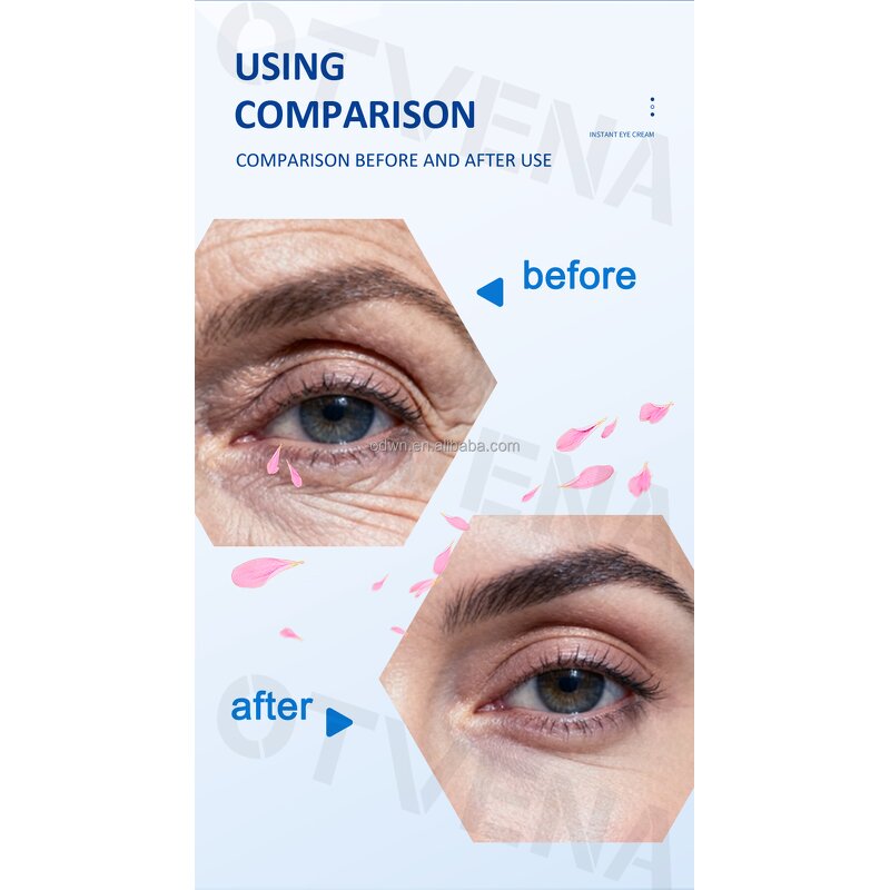 Eye Cream Manufacturer - OEM Dark Circle & Fine Lines Removal 8ml