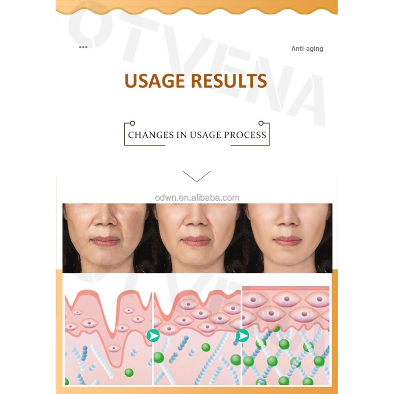 Anti Aging Cream Manufacturer - Thailand Hot Selling Collagen Moisturizer