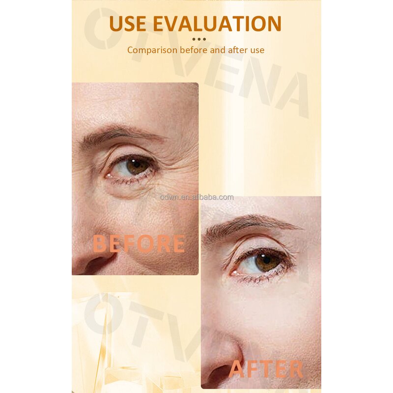 Eye Serum Manufacturer - Dual Essence with Cooling Massage Head