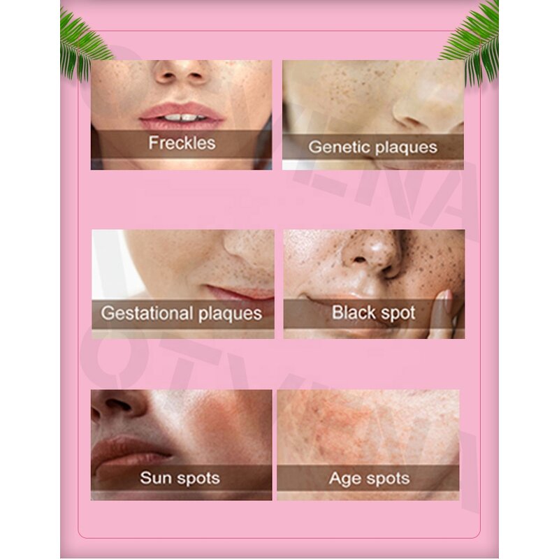 Whitening Cream Manufacturer - For All Skin Types Fades Spots Moisturizes