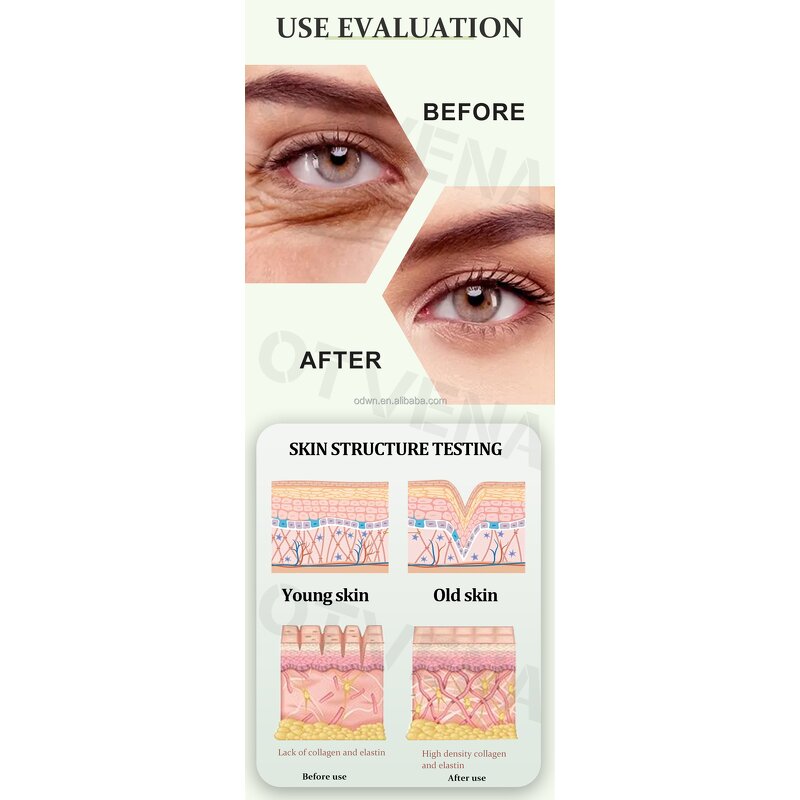 Eye Cream Manufacturer - OEM Peptide Eye Rejuvenation 12ml